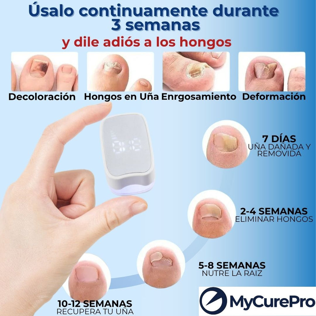 Eliminador láser antihongos-Resultados en 7 días.